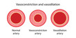 Arterial vasoconstriction and vasodilation. Comparison illustration of normal, constricted, and dilated blood vessels. Diagram of cross section of arteries. Vector illustration