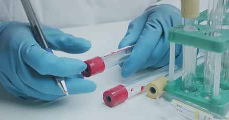 Wall Mural - close up shot of laboratory assistant signs pen test tubes to collect analysis and further research