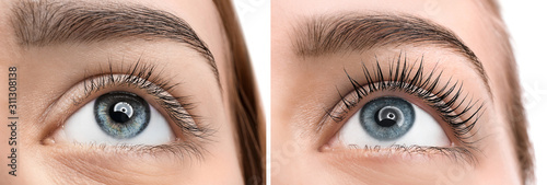 Cuadros en Lienzo Beautiful young woman before and after eyelashes lamination, closeup
