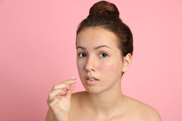 teen girl applying acne healing patch on light pink background