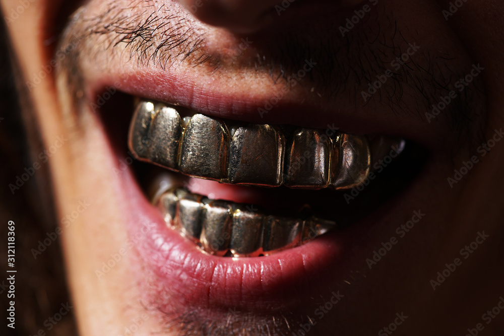 Look Like Rih Rich man with golden teeth close up. Look like rich men. Golden ...