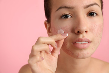 teen girl applying acne healing patch on light pink background