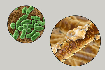 Wall Mural - Human hair with dandruff and close-up view of microscopic fungi Malassezia furfur that cause dandruff and seborrhoeic dermatitis, 3D illustration