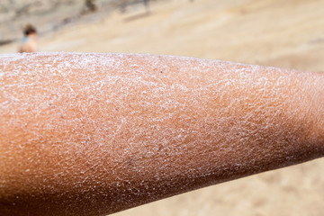 Arm covered by salt after bathing in the Dead Sea, Jordan