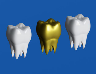 Wall Mural - Golden tooth next to white teeth, gold crown tooth. 3d illustration