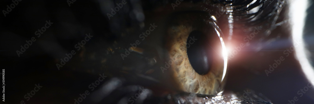 Laser vision correction concept. Female eye on surgery clinic exam closeup. Treatment for astegmatism and myopia - obrazy, fototapety, plakaty 