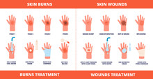 Skin First Aid. Burns Treatment, Wounds And Trauma Symptoms. Degree Burn, Help Hand Healing With Cream, Bandaging And Pills Vector Poster. Injury Skin And Wound Care, Treatment Hurt Illustration