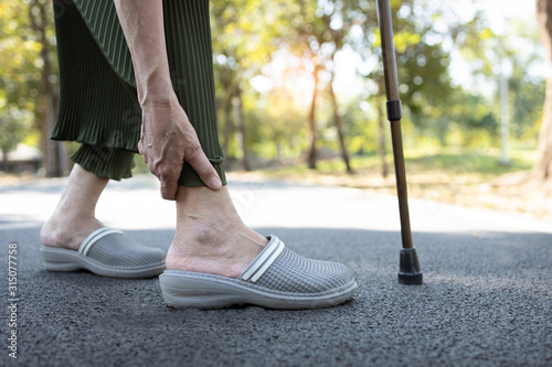 Closeup of legs of senior woman feeling pain in the joints bones,ankle tendon injury,gout disease,osteoarthritis,ligament and muscle problems,elderly people touching ankle due to sprain after walk