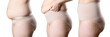 © staras - Woman's body before and after weight loss, fat woman in corrective panties isolated on white background