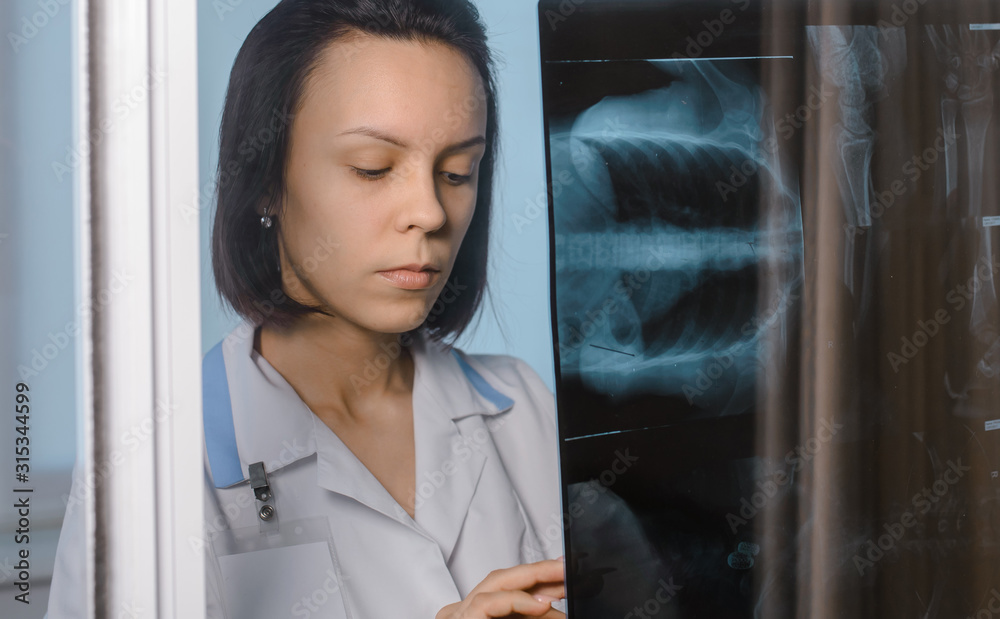Young female doctor analyse chest x-ray radiography in clinic Stock ...