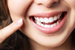 Leinwandbild Motiv Perfect healthy teeth smile of a young woman. Teeth whitening. Dental clinic patient. Image symbolizes oral care dentistry, stomatology