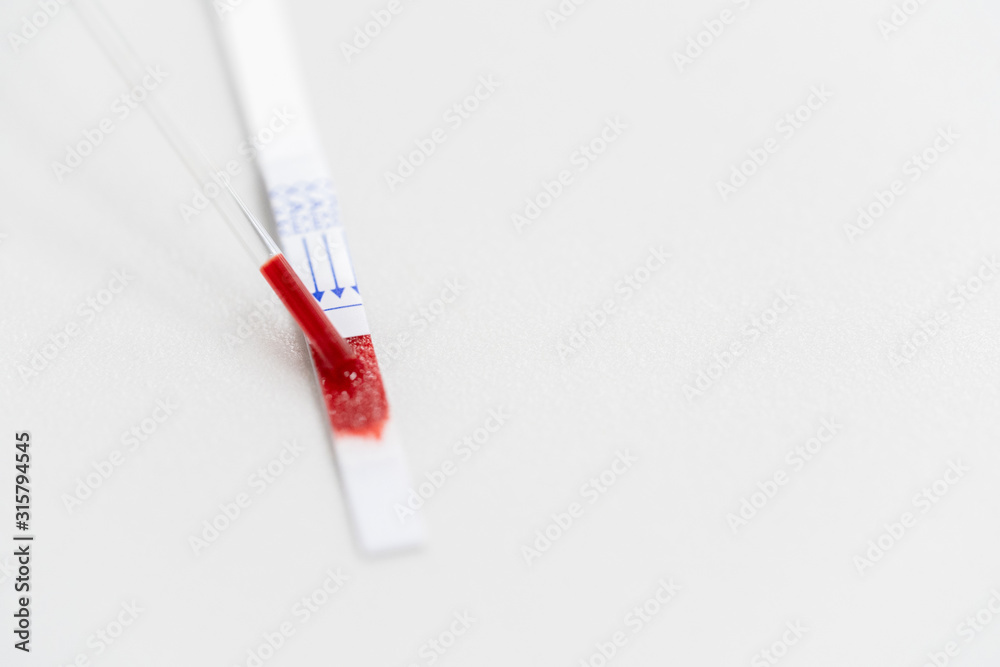 Hepatitis B Surface Antigen (HBsAg) Test Strip is a rapid, qualitative ...