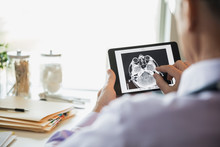 Doctor Examining CT Scan On Digital Tablet