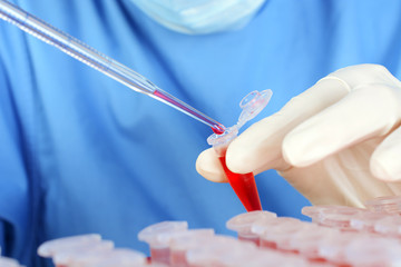 Wall Mural - Scientist or doctor with reaction tube and pipette during examination and evaluation of sample