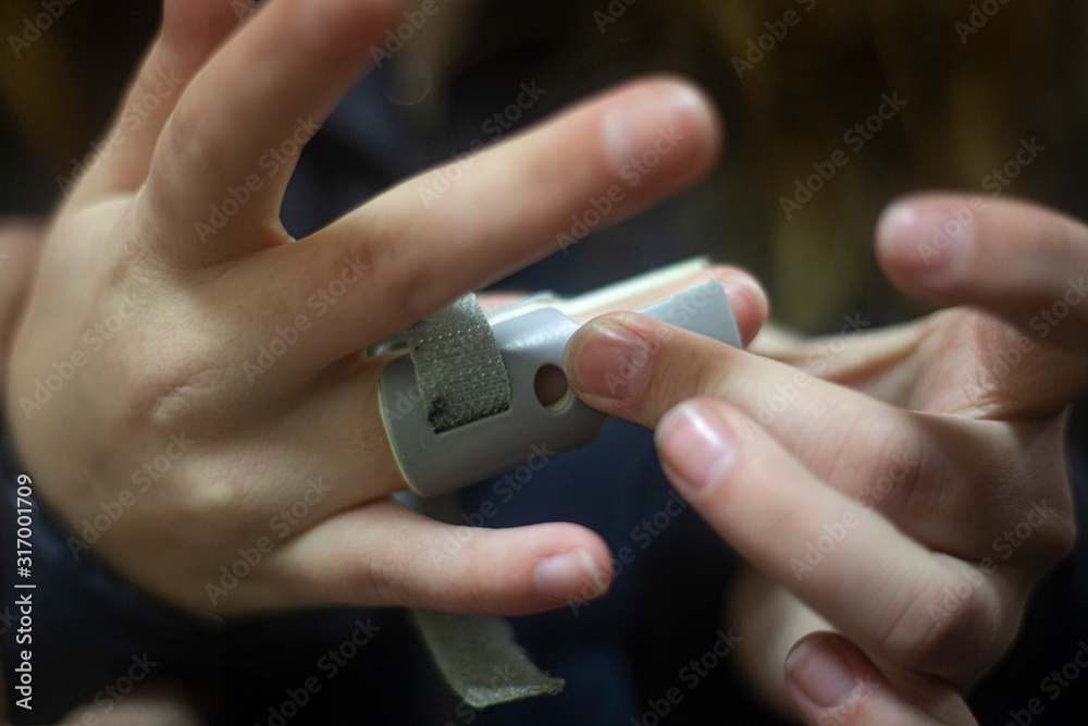 Finger Injury First Aid Applying a bandage to a broken finger. Fixing a broken finger for bone ...
