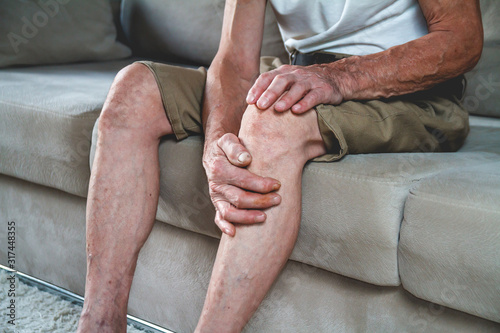 Pain in the legs and knees of an elderly seniorv Tableau sur Toile