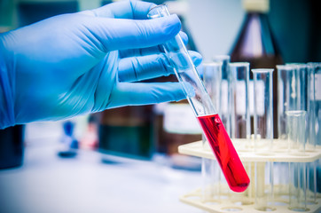 woman's hand in blue gloves holds a glass test tube (Proberochr) with red (purple) water (blood, liquid) in the laboratory close-up