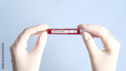 Fotomural Hands in white medical gloves holding test tube with blood for 2019-nCoV coronavirus analyzing
