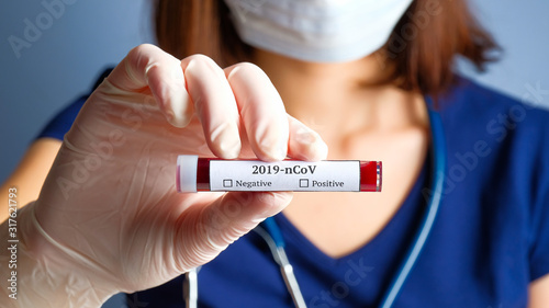 Cuadros en Lienzo Nurse holding test tube with blood for 2019-nCoV analyzing