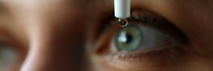 Wall Mural - Female putting liquid drops in her eye solving vision problem