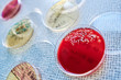 Petri dishes with bacterial colonies