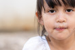 Close up face of asian little girl with snot runny nose from common cold and allergy symptom, concept of health care in child and impact of health from viral and air pollution.