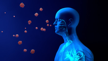 Droplets infected with a virus spray into the air, Human lungs infected by the Coronavirus or by virus, Respiratory infection caused by a virus. SARS