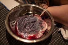 A Close Up Detailed View Of A Bloody Human Placenta, Maternal Side, With Intact Umbilical Cord In A Sterile Dish Shortly After Childbirth, Copy Space To Sides