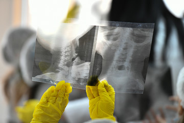 X-ray photograph in the hands. The child is holding an x-ray in his hands. A child in a medical uniform observes an x-ray of the head. Medical training