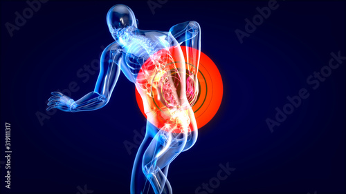 Cuadros en Lienzo Man suffering from severe back pain