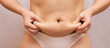 Fat unhealthy woman body. Pinch belly side. Measurement lady procedure. Medicine pinching. Anti cellulite overweight