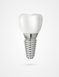 vector tooth implant 3d illustration