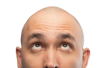 image of bald man looking up, half head
