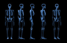Set Of Human Skeleton X-ray