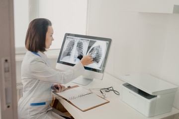 Young woman radiologist doctor analysis x-ray