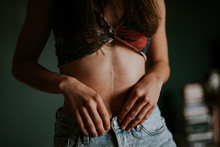 Detail Of Big Belly Scar On Female Body