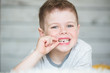 © Kirill Grekov - Teenager child with a tooth dropped out