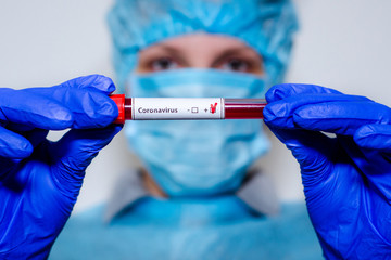 Medical laboratory assistant holding test tube with positive Coronavirus test blood sample.