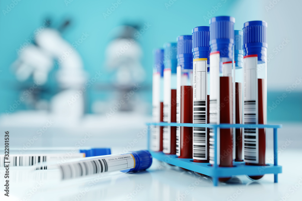 A row of human blood samples in a medical laboratory ready to be tested. healthcare background 3D illustration. - obrazy, fototapety, plakaty 