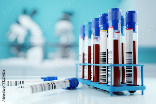 Fotomural A row of human blood samples in a medical laboratory ready to be tested