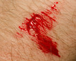 Blood on human skin close-up