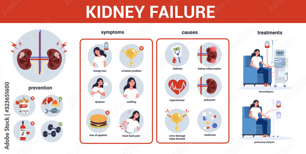 Kidney Failure Infographic Symptoms Causes Prevention And Treatment