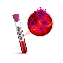 Test Tube With Positive Coronavirus Result. Chinese Coronavirus Or COVID-2019 Blood Test Concept.