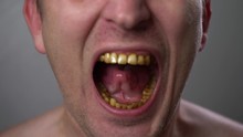 A Man With Yellow Teeth Aggressively Grins. Close-up Smoker's Teeth. Negative Emotions On The Face. Anger Emotions. Anger. Violence. Tooth Disease.