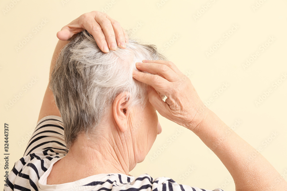 Senior woman with hair loss problem on color background