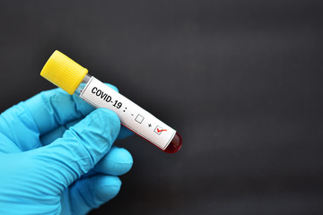 Blood sample tube positive with COVID-19 or novel coronavirus 2019 found in Wuhan, China