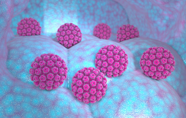 Human papillomavirus infection. Virus. HPV is the most common sexually transmitted infection globally. HPV infection is caused by human papillomavirus, a DNA virus from the papillomavirus family, 3d