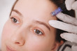 Close up of a young woman receiving microinjections in her forehead, getting mesotherapy treatment by beautician