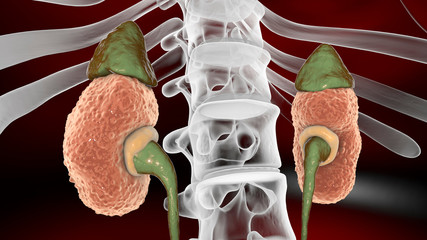 Wall Mural - Gross pathology of chronic glomerulonephritis