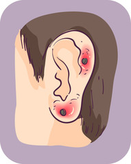 Poster - Man Irritated Ear Piercing Illustration